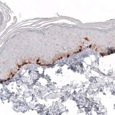 Immunohistochemistry-Paraffin: Melan-A/MART-1 Antibody (CL12864) [NBP3-18562]