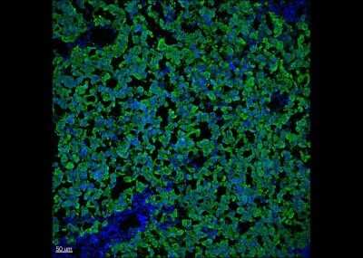 Immunohistochemistry-Paraffin: Melan-A/MART-1 Antibody (DT101 + BC199) - Azide and BSA Free [NBP2-34607]