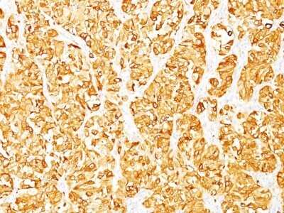 Immunohistochemistry-Paraffin: Melan-A/MART-1 Antibody (M2-7C10) - Azide and BSA Free [NBP2-33148]