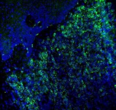 Immunohistochemistry: Melan-A/MART-1 Antibody (M2-7C10) - IHC-Prediluted [NBP2-44386]