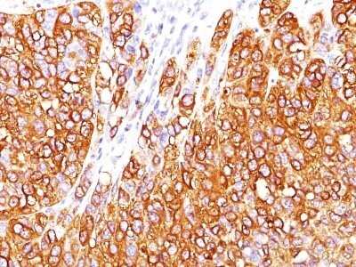 Immunohistochemistry-Paraffin: Melan-A/MART-1 Antibody (M2-7C10) - IHC-Prediluted [NBP2-44386]