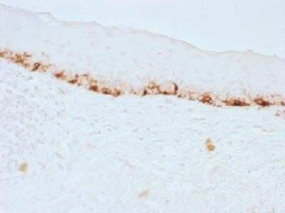 Immunohistochemistry-Paraffin: Melan-A/MART-1 Antibody (M2-7C10) - IHC-Prediluted [NBP2-44386]