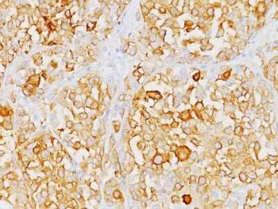 Immunohistochemistry-Paraffin: Melan-A/MART-1 Antibody (M2-9E3) - IHC-Prediluted [NBP2-44388]