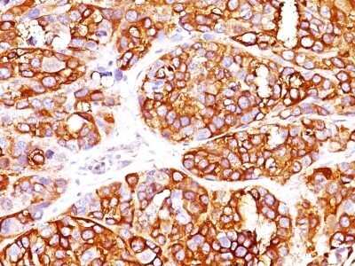 Immunohistochemistry-Paraffin: Melan-A/MART-1 Antibody (MLANA/1409R) [NBP2-53301]