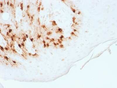 Immunohistochemistry-Paraffin: Melan-A/MART-1 Antibody (MLANA/1761R) - Azide and BSA Free [NBP2-54568]