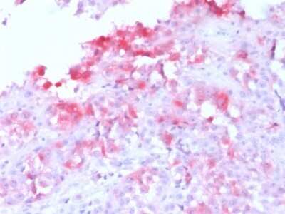 Immunohistochemistry-Paraffin: Melan-A/MART-1 Antibody (MLANA/1761R) [NBP2-53294]