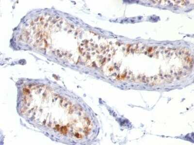 Immunohistochemistry-Paraffin: Melan-A/MART-1 Antibody (MLANA/788) - IHC-Prediluted [NBP2-48209]