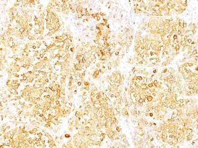 Immunohistochemistry-Paraffin: Melan-A/MART-1 Antibody (SPM540) - Azide and BSA Free [NBP2-34786]