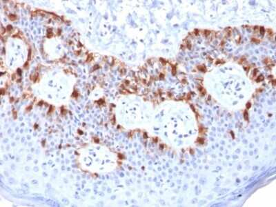 Immunohistochemistry-Paraffin: Melan-A/MART-1 Antibody (rMLANA/788) - Azide and BSA Free [NBP2-54444]