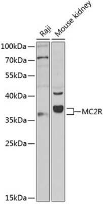 Western Blot: Melanocortin-2 R/MC2R AntibodyAzide and BSA Free [NBP3-03859]
