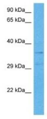 Western Blot: Melanocortin-3 R/MC3R Antibody [NBP3-10029]