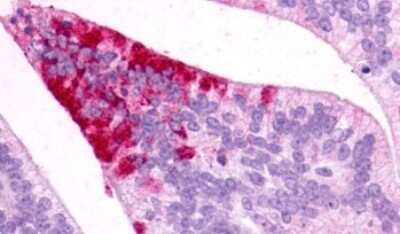 Immunohistochemistry-Paraffin: Melanocortin-5 R/MC5R Antibody - BSA Free [NLS1022]
