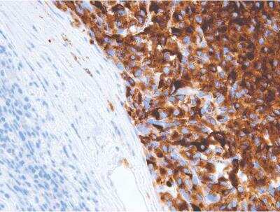 Immunohistochemistry-Paraffin: Melanoma Associated Antigen (KBA.62) Antibody (IHC062) [NBP2-75984]