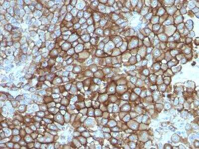 Immunohistochemistry-Paraffin: Melanoma Associated Antigen (KBA.62) Antibody (KBA.62) - IHC-Prediluted [NBP2-48210]