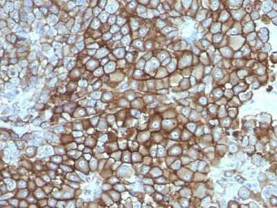 Immunohistochemistry-Paraffin: Melanoma Associated Antigen (KBA.62) Antibody (KBA.62) [NBP2-45285]