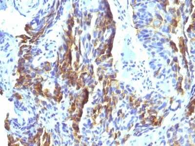 Immunohistochemistry-Paraffin: Melanoma Associated Antigen (KBA.62) Antibody (KBA.62) [NBP2-45285]