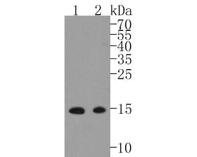 Western Blot: Melanoma HMB45 + MART1 + Tyrosinase Antibody (SC56-02) [NBP2-67589]