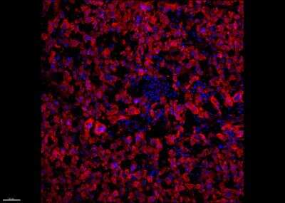 Immunohistochemistry-Frozen: Melanoma Marker (MART-1 + Tyrosinase + gp100) Antibody (M2-7C10 + M2-9E3 + T311 + HMB45) - Azide and BSA Free [NBP2-34681]