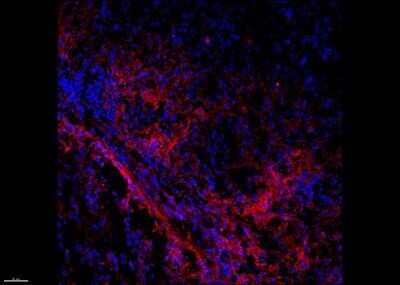 Immunohistochemistry-Frozen: Melanoma Marker (MART-1 + Tyrosinase + gp100) Antibody (M2-7C10 + M2-9E3 + T311 + HMB45) [NBP2-34337]