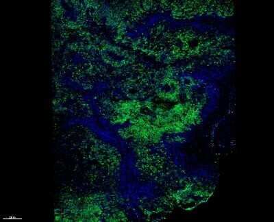 Immunohistochemistry: Melanoma Marker (MART-1 + Tyrosinase + gp100) Antibody (M2-7C10 + M2-9E3 + T311 + HMB45) [NBP2-34337]