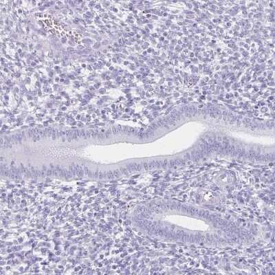 Immunohistochemistry-Paraffin: Melanoma antigen family C2 Antibody [NBP2-34145]