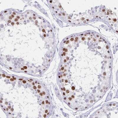 Immunohistochemistry-Paraffin: Melanoma antigen family C2 Antibody [NBP2-34145]