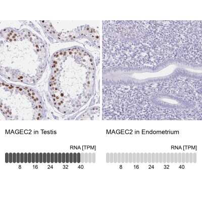 Immunohistochemistry-Paraffin: Melanoma antigen family C2 Antibody [NBP2-34145]