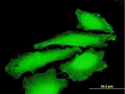 Immunocytochemistry/ Immunofluorescence: Melanoma antigen family E1 Antibody [H00057692-B02P]