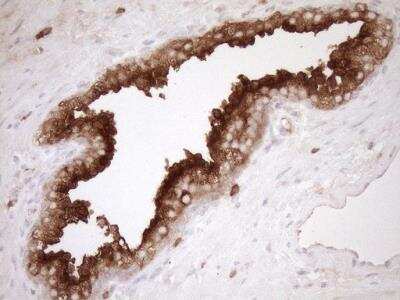 Immunohistochemistry: Melanophilin Antibody (OTI6E8) [NBP2-45883]