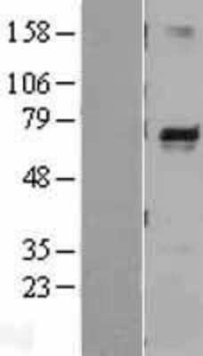 Western Blot: Melanophilin Overexpression Lysate [NBL1-13139]