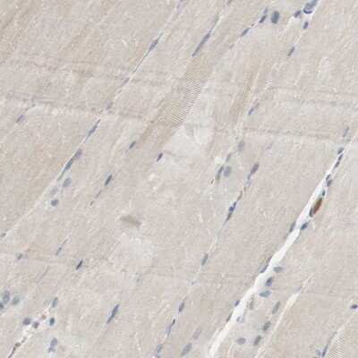 Immunohistochemistry-Paraffin: Melanotransferrin/CD228/MFI2 Antibody [NBP1-85777]