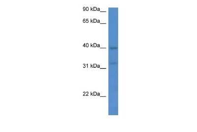 Western Blot: Melatonin R1A/MT1/MTNR1A Antibody [NBP2-84159]
