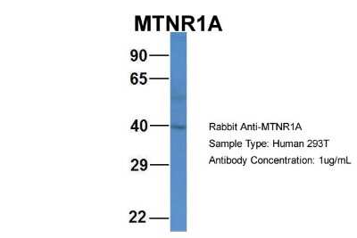 Western Blot: Melatonin R1A/MT1/MTNR1A Antibody [NBP2-84159]
