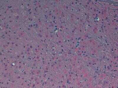 Immunohistochemistry: Melatonin Receptor 1B Antibody - BSA Free [NLS932]