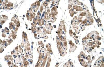 Immunohistochemistry-Paraffin: Melusin/ITGB1BP2 Antibody [NBP1-55149]