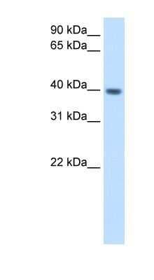Western Blot: Melusin/ITGB1BP2 Antibody [NBP1-55149]