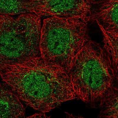 Immunocytochemistry/ Immunofluorescence: Membrin Antibody [NBP2-47379]