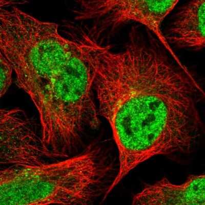 Immunocytochemistry/ Immunofluorescence: Membrin Antibody [NBP2-54985]