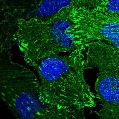 Immunocytochemistry/ Immunofluorescence: Mena Antibody [NBP1-87914]