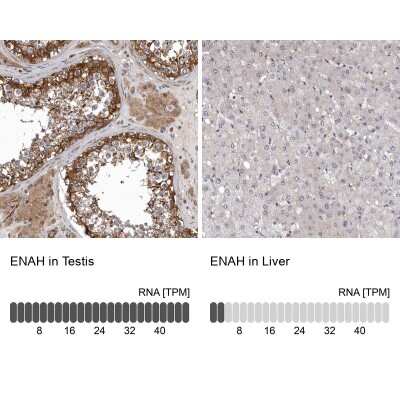 Immunohistochemistry-Paraffin: Mena Antibody [NBP1-87914]