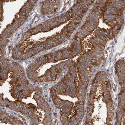 Immunohistochemistry-Paraffin: Mena Antibody [NBP1-87915]