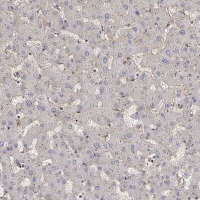 Immunohistochemistry-Paraffin: Mena Antibody [NBP1-87915]