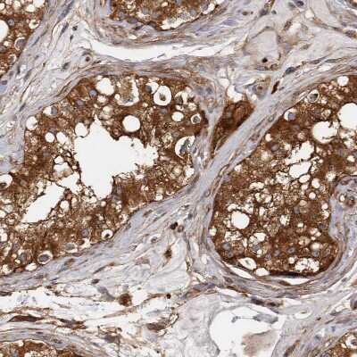 Immunohistochemistry-Paraffin: Mena Antibody [NBP1-87915]