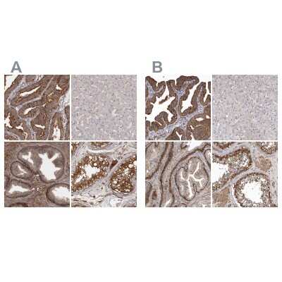 Immunohistochemistry-Paraffin: Mena Antibody [NBP1-87915]