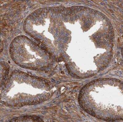 Immunohistochemistry-Paraffin: Mena Antibody [NBP1-87915]