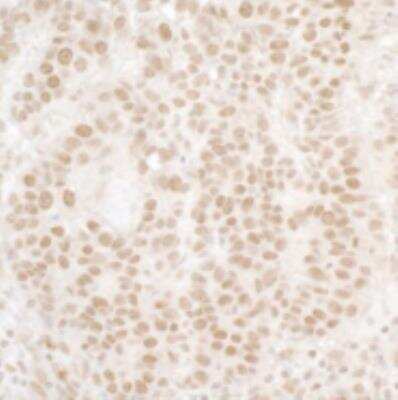 Immunohistochemistry-Paraffin: Menin Antibody [NB100-215]
