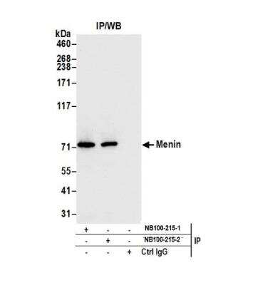 Immunoprecipitation: Menin Antibody [NB100-215]