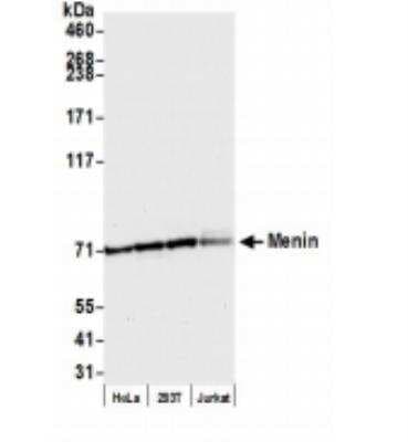 Western Blot: Menin Antibody [NB100-215]