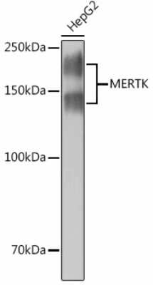 Western Blot: Mer Antibody (4I1P7) [NBP3-15440]