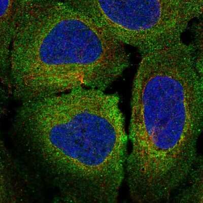 Immunocytochemistry/ Immunofluorescence: Mer Antibody [NBP2-58025]